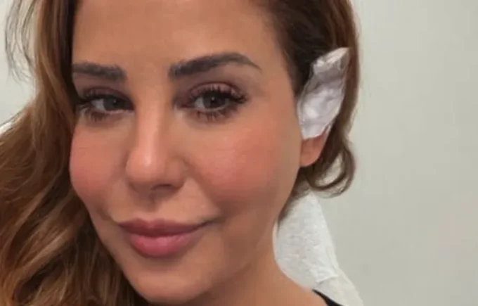 Myrka Dellanos revela que fue diagnosticada con cáncer de piel