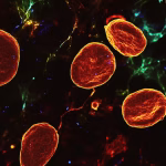 Descubren una proteína sanguínea que podría frenar el avance del cáncer de páncreas